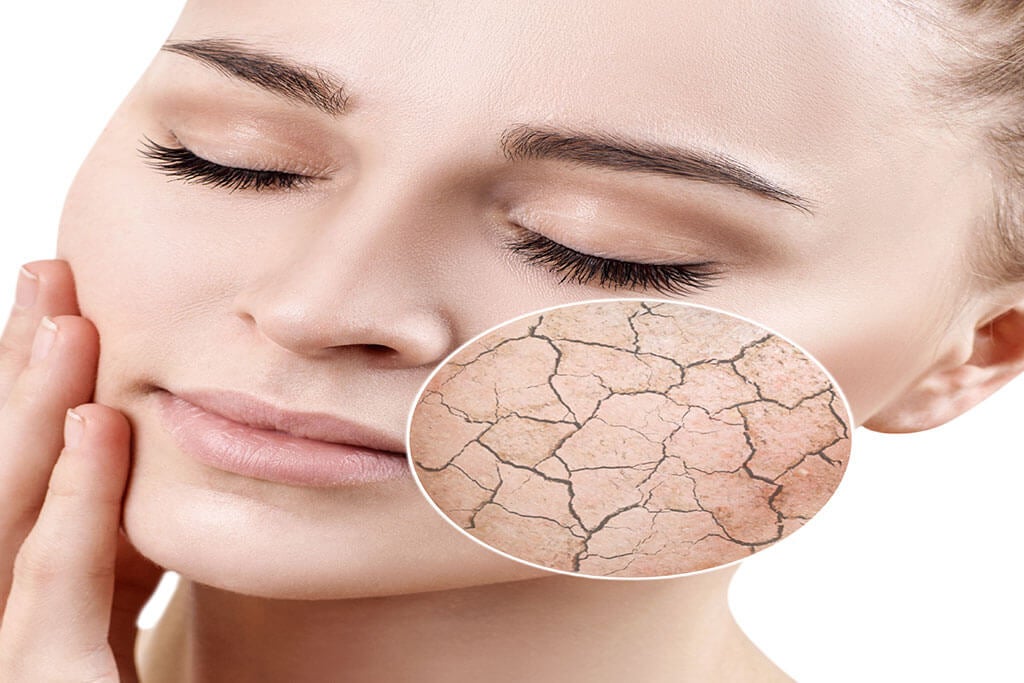 3 alternativas para evitar la resequedad en la piel