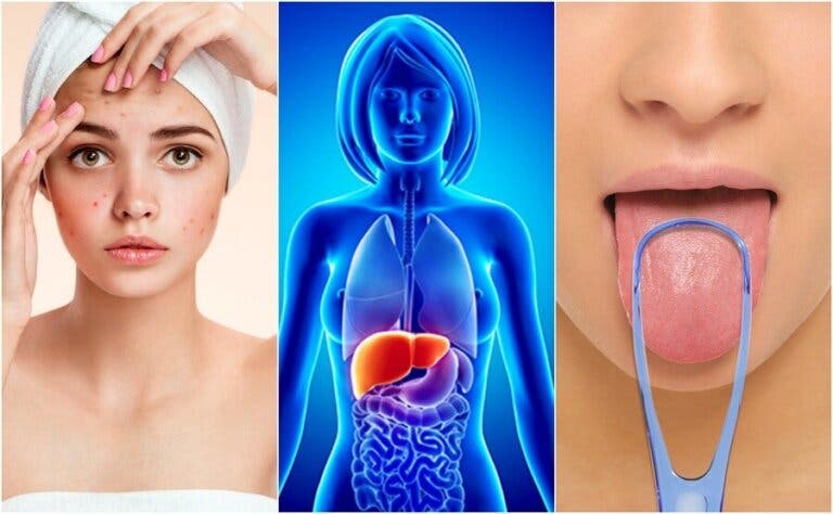 Señales de advertencia de que tu hígado está lleno de toxinas