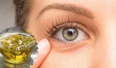 Cómo disminuir la hinchazón en los ojos con estos 5 trucos caseros
