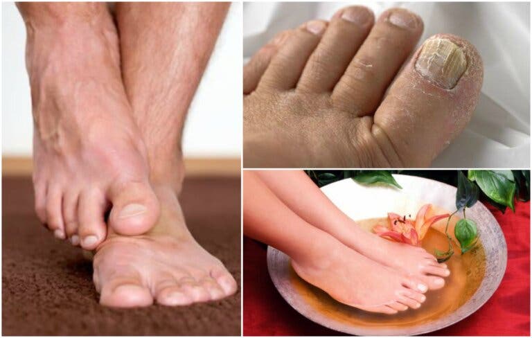 Cómo identificar si tienes hongos en los pies