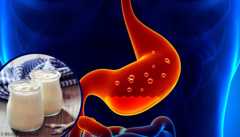 ¿Cómo tratar la gastritis de forma rápida y casera?