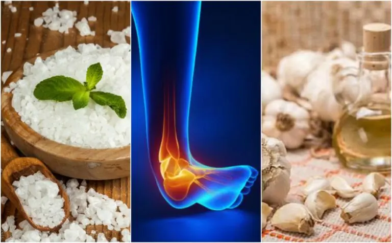 Calma el dolor del esguince de tobillo con estos 5 remedios naturales