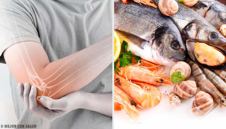 ¿Comer pescado genera menos dolor por artritis reumatoide?