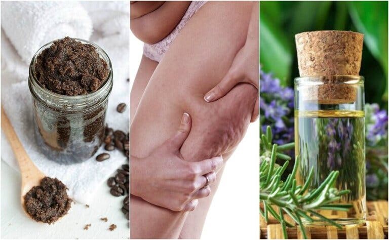 ¿Quieres reducir el aspecto de la celulitis? Anota estos 5 remedios caseros