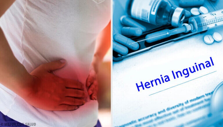 Remedio Casero Para Ayudar A Desinflamar Las Hernias Mejor Con Salud 0918