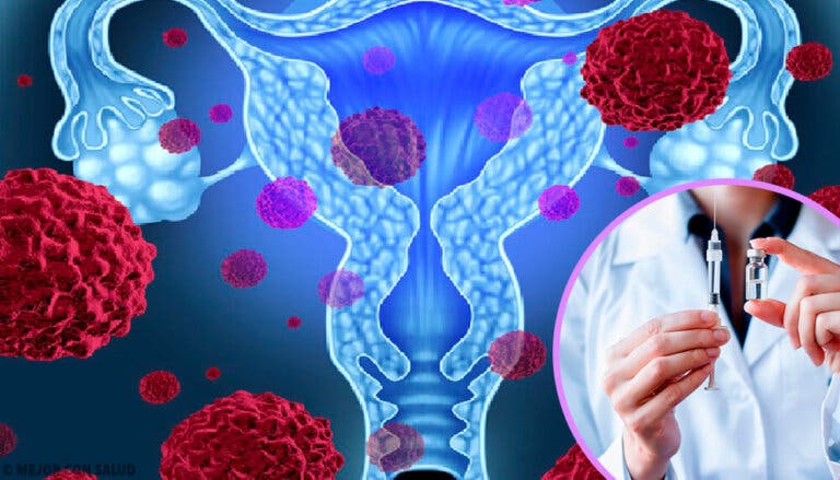 Virus del Papiloma Humano