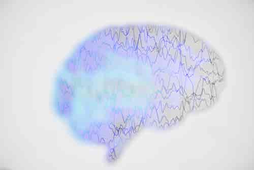 crisis epilépticas en el cerebro