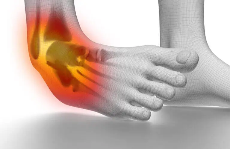 6 tips para prevenir y tratar esguinces de tobillo