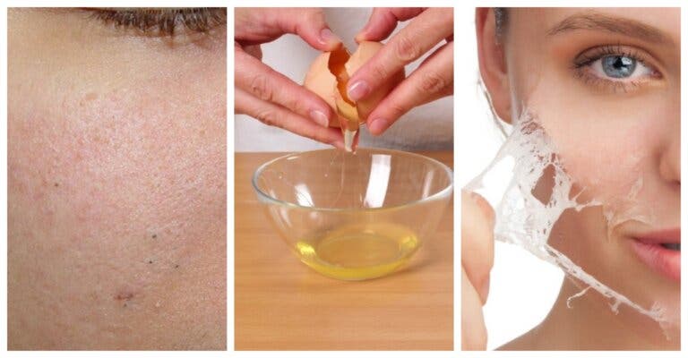 Acerca de los exfoliantes caseros para quitar los puntos negros