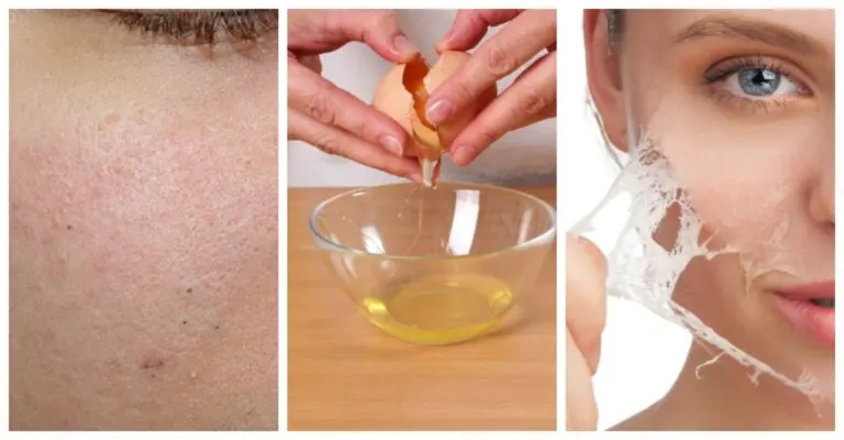 Acerca de los exfoliantes caseros para quitar los puntos negros