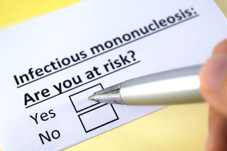 Mononucleosis infecciosa
