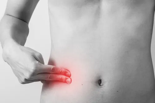 Situación anatómica de apendicitis