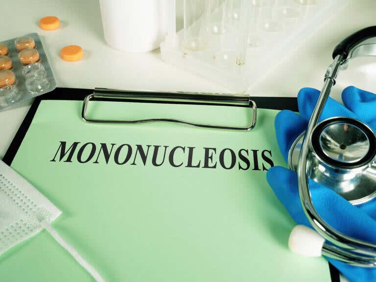 Tratamiento de la mononucleosis infecciosa