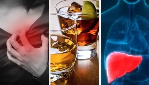 7 factores por los que puedes tener la GGT alta