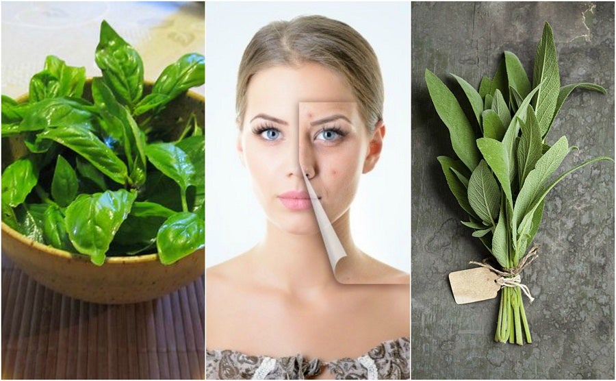 5 hierbas para combatir el acné