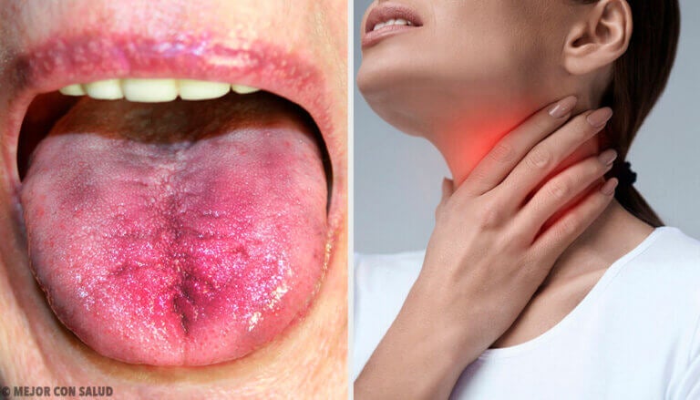 Alojamiento Edredón estético 6 formas de saber si hay placa en la garganta - Mejor con Salud