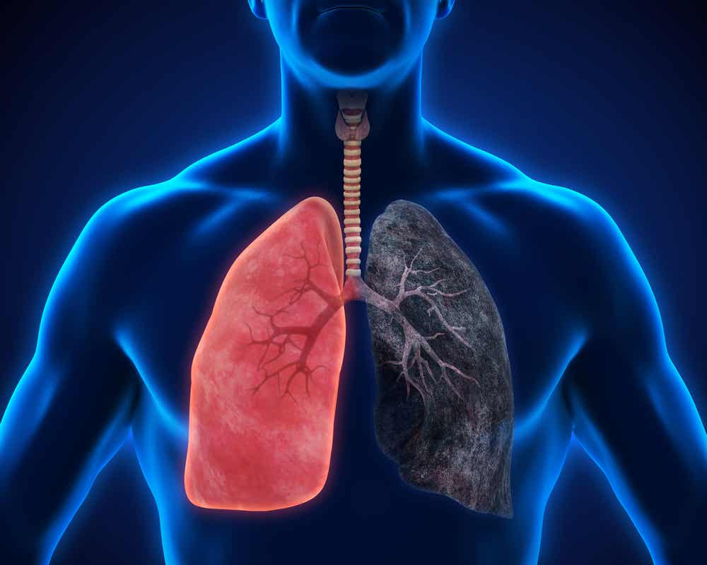 Malos hábitos que deterioran tu salud pulmonar