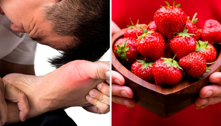 Alimentos que reducen el ácido úrico