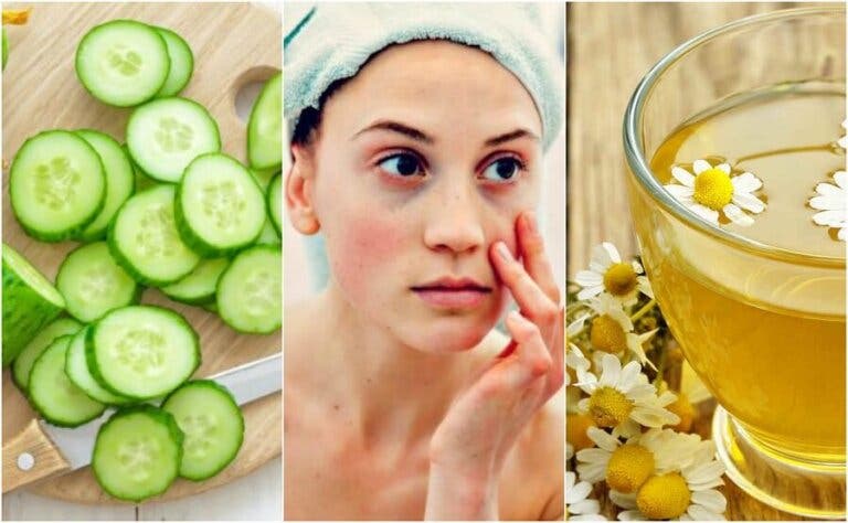 Cómo disminuir las bolsas y ojeras usando 5 ingredientes naturales