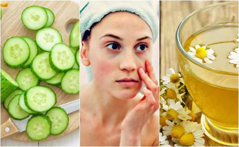 Cómo disminuir las bolsas y ojeras usando 5 ingredientes naturales