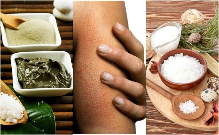 Cómo preparar 5 exfoliantes naturales para combatir los granitos en los brazos
