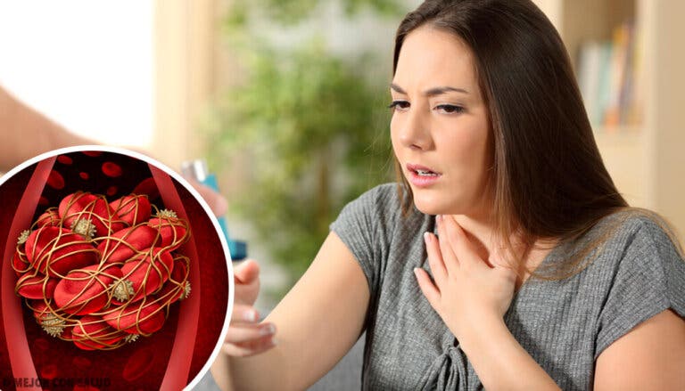 Coágulos en la sangre: 8 señales para estar alerta