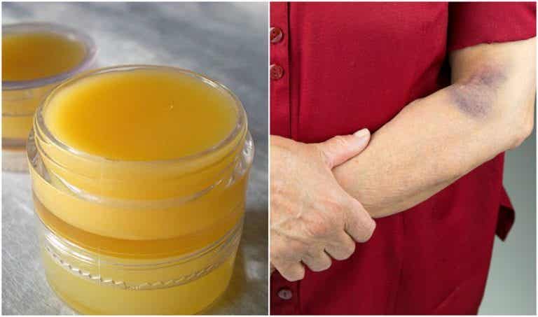 Cómo preparar una crema terapéutica de árnica para curar las contusiones