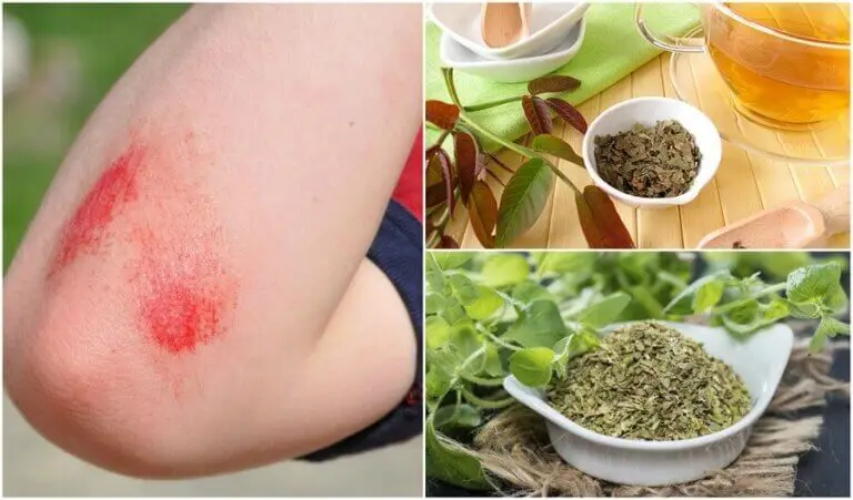 Limpiar heridas superficiales con antisépticos naturales