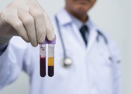 Diferencia entre suero y plasma sanguíneo