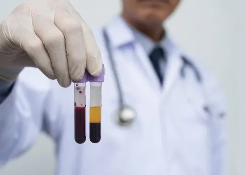 Diferencia entre suero y plasma sanguíneo