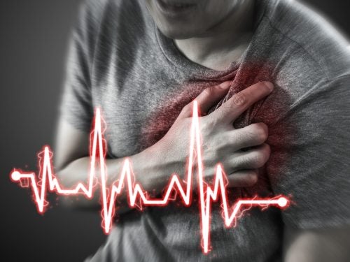 Epidemiología del infarto agudo de miocardio