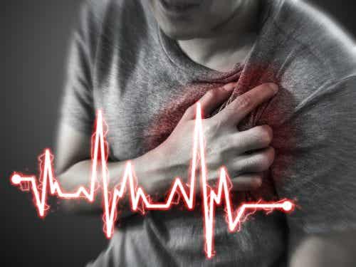 Epidemiología del infarto agudo de miocardio