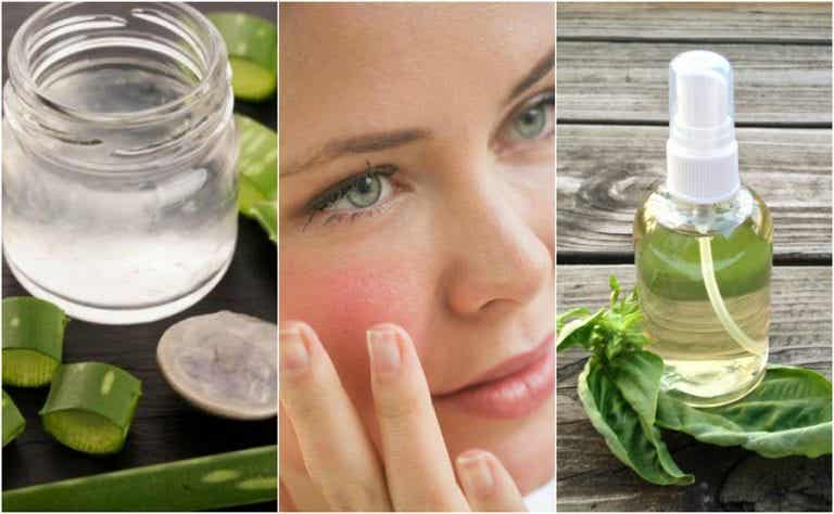 Los 5 mejores remedios caseros para calmar la piel irritada