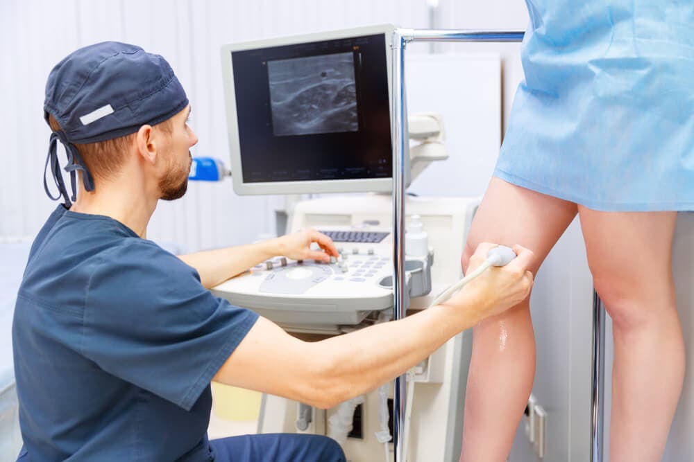 Por qué salen las varices
