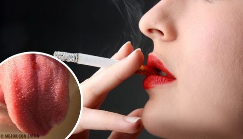 ¿Por qué se produce la inflamación de las papilas gustativas?