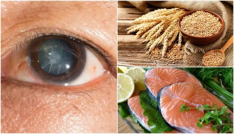 Reduce el riesgo de cataratas consumiendo estos 7 alimentos