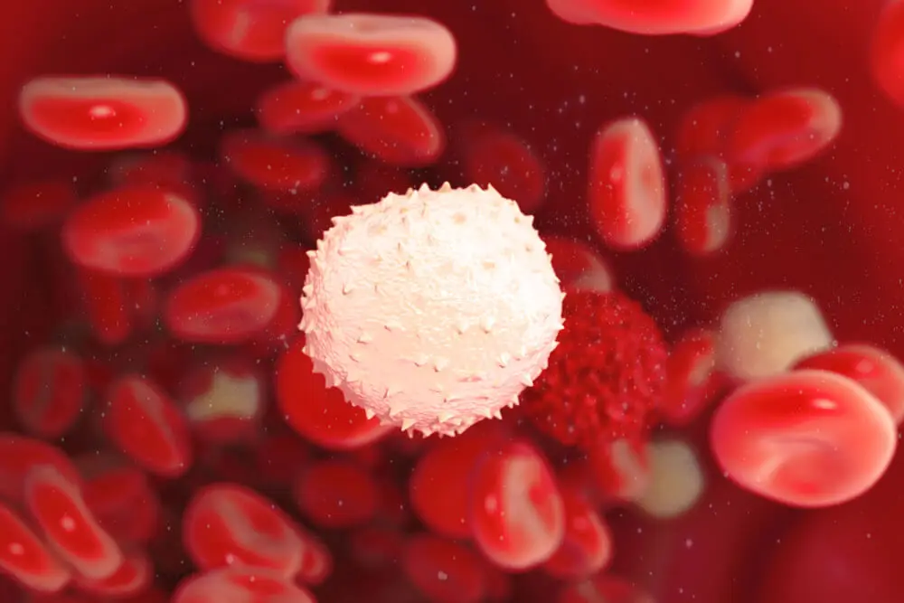 Leucopenia en aciduria orgánica