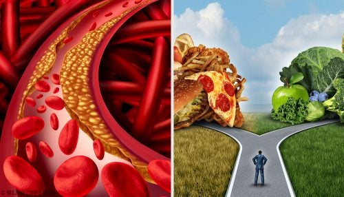 Tratamiento de la aterosclerosis