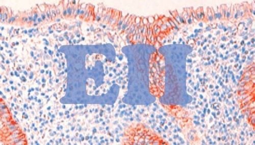 La enfermedad inflamatoria intestinal (EII): anatomía de un dolor silencioso