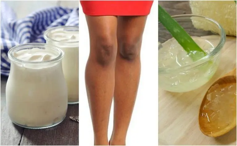 Dile adiós a las manchas en las rodillas con estos 5 tratamientos caseros