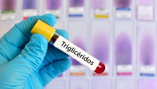 triglicéridos