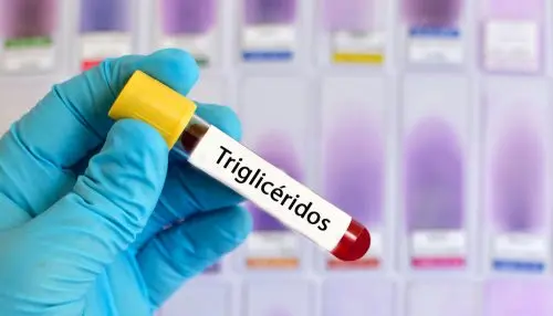triglicéridos