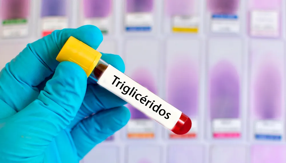 bajar los triglicéridos