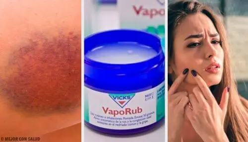 11 usos que no conocías del famoso Vicks VapoRub