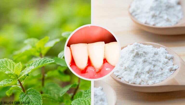 5 remedios caseros efectivos para la gingivitis