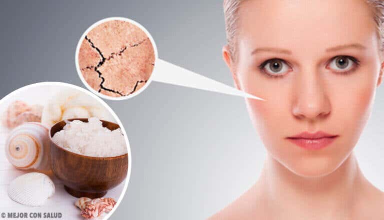 5 remedios naturales para eliminar la sequedad de la piel por completo