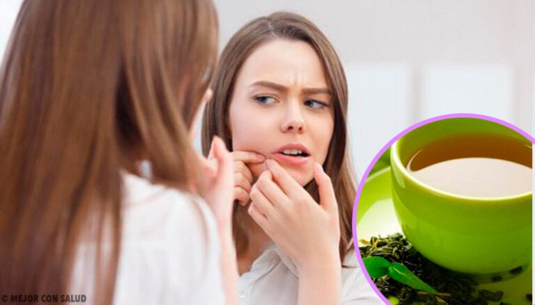 6 formas de emplear el té verde contra el acné