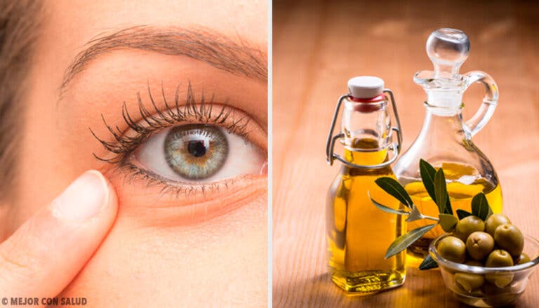 6 remedios naturales contra la inflamación ocular