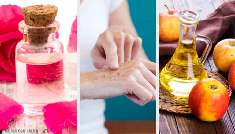 8 remedios naturales para aclarar las manos