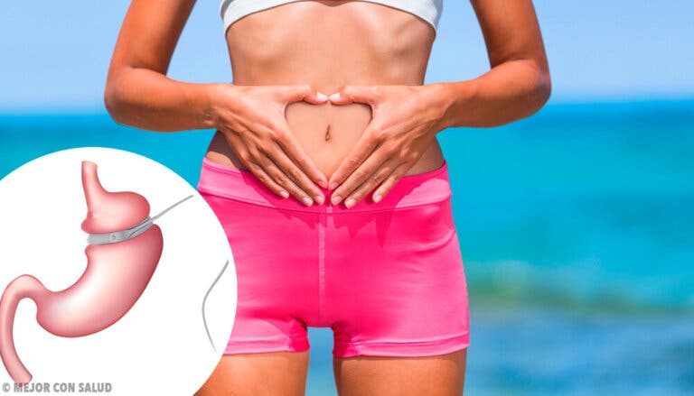 Beneficios y efectos secundarios del bypass gástrico